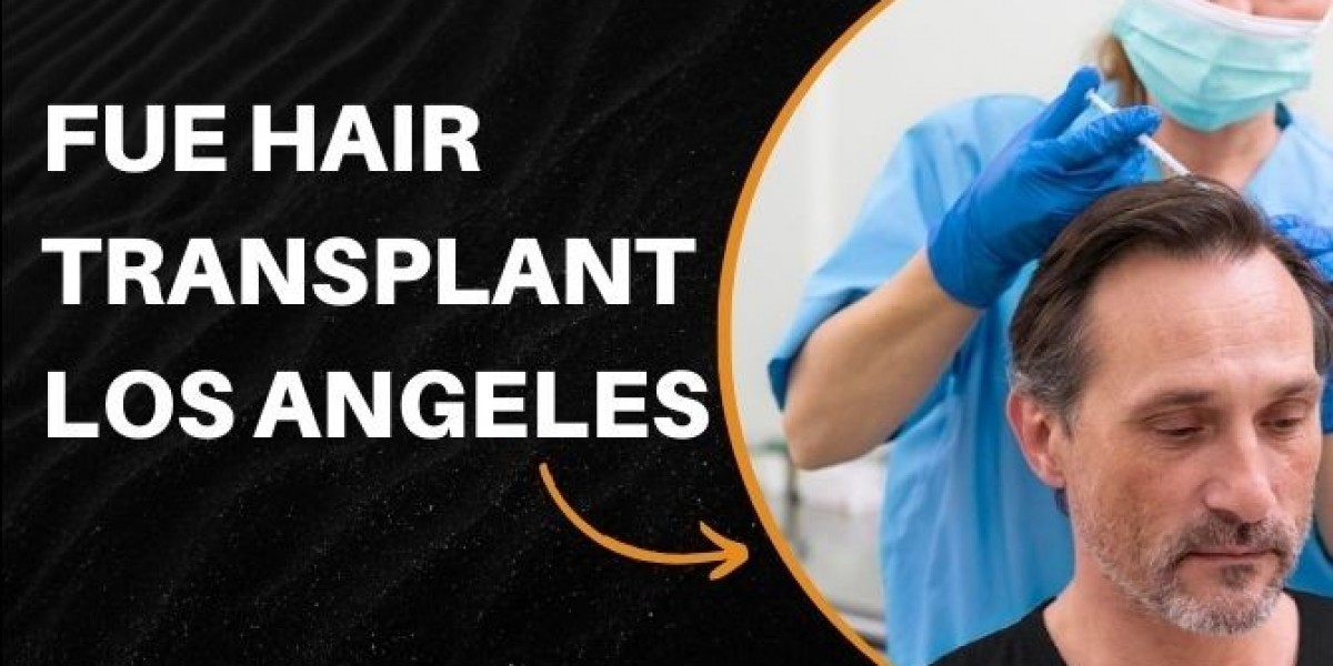 Discovering the Best FUE Hair Transplant in Los Angeles