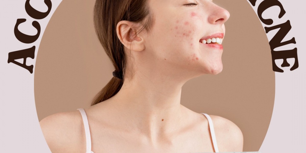 How to Start Using Accutane: A Comprehensive Guide